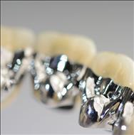 Remanium CSE  aliaj ceramica
