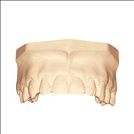 Kamarock    gips clasa IV-a,     pret / kg,    CAD-CAM