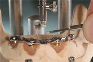 OT CEM - Ciment compozit DUAL (foto & auto)  5 ml